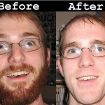 nose hair trimmer before and after